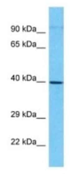 MAB21L3 Rabbit anti-Human, Polyclonal, Novus Biologicals 100 &mu;g | Buy Online | Novus Biologicals | Fisher Scientific